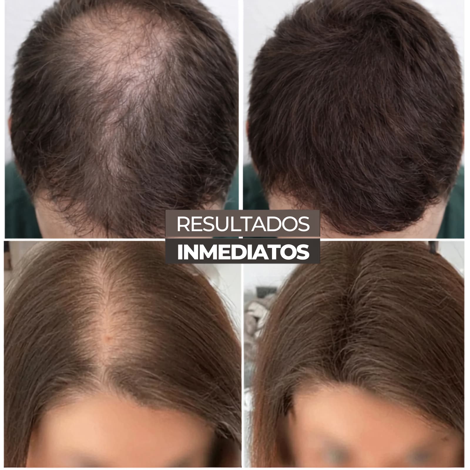 Toppík 3 en 1 Rellenador de cabello